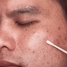 GREEN MAGIC MASK: ¡ Mascarilla Revolucionaria! (PAGA AL RECIBIR y Envío GRATIS)🌿🥰🌟